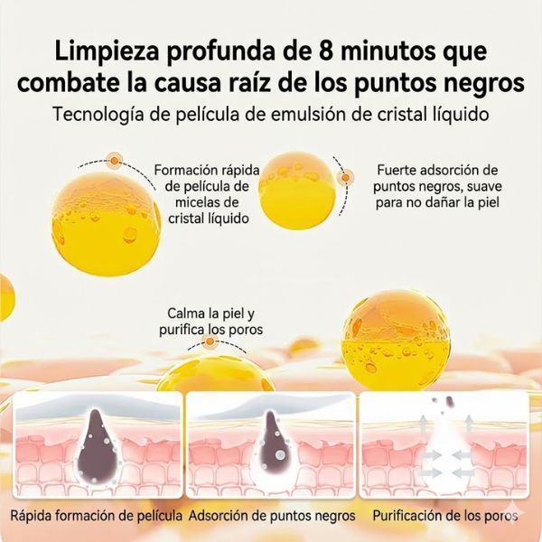 Lanbena: Tratamiento Intensivo contra Puntos Negros