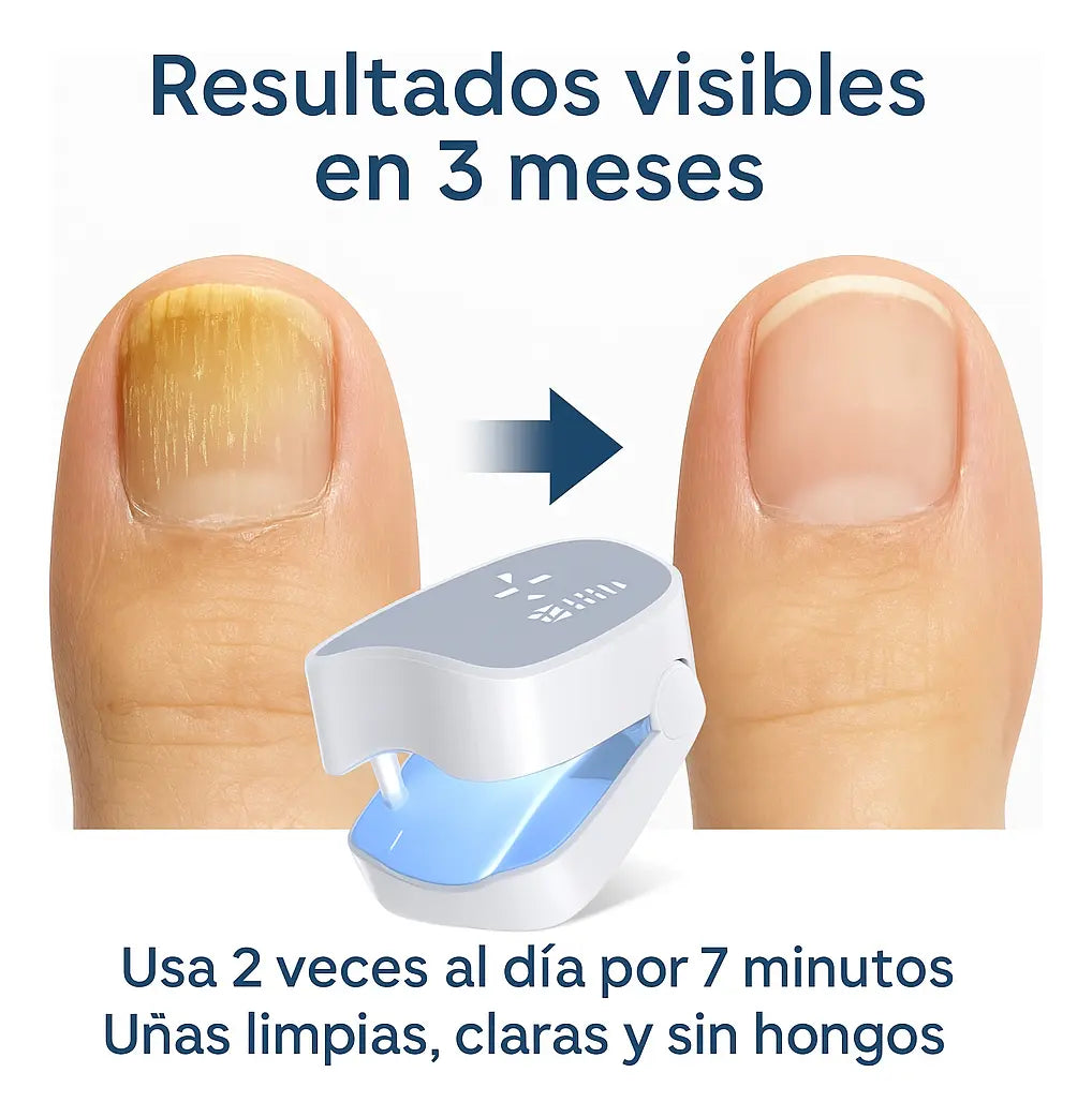 Láser Anti-Hongos NÍTIDA