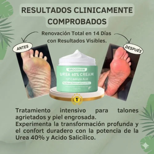 Crema de Urea al 40% para piel seca, dura y agrietada