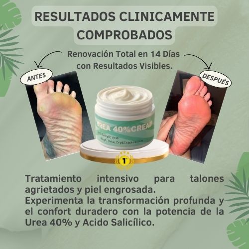Crema de Urea al 40% para piel seca, dura y agrietada