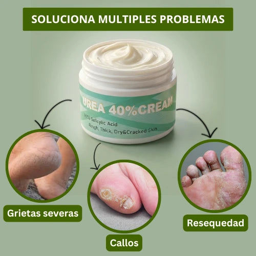 Crema de Urea al 40% para piel seca, dura y agrietada